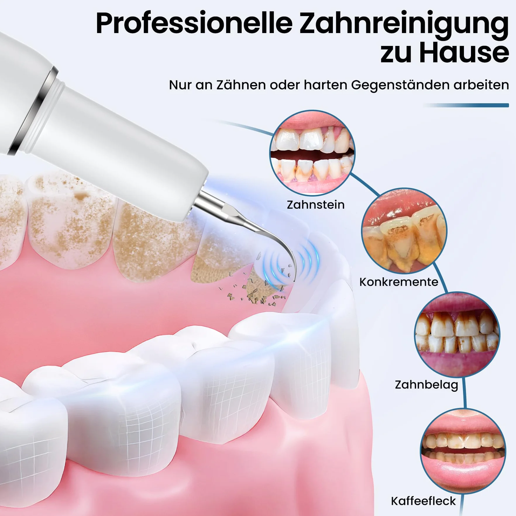 Kit Pulizia Denti Tartaro, Kit Pulizia Denti Animali Domestici, 5 modalità di Spazzolino Denti Cane, Pulizia Denti tartaro con 4 Teste Intercambiabili Per Spazzolare il Tartaro da Persone e Animali